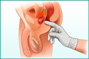 Touching prostate